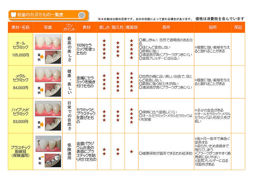 	前歯のかぶせもの一覧表