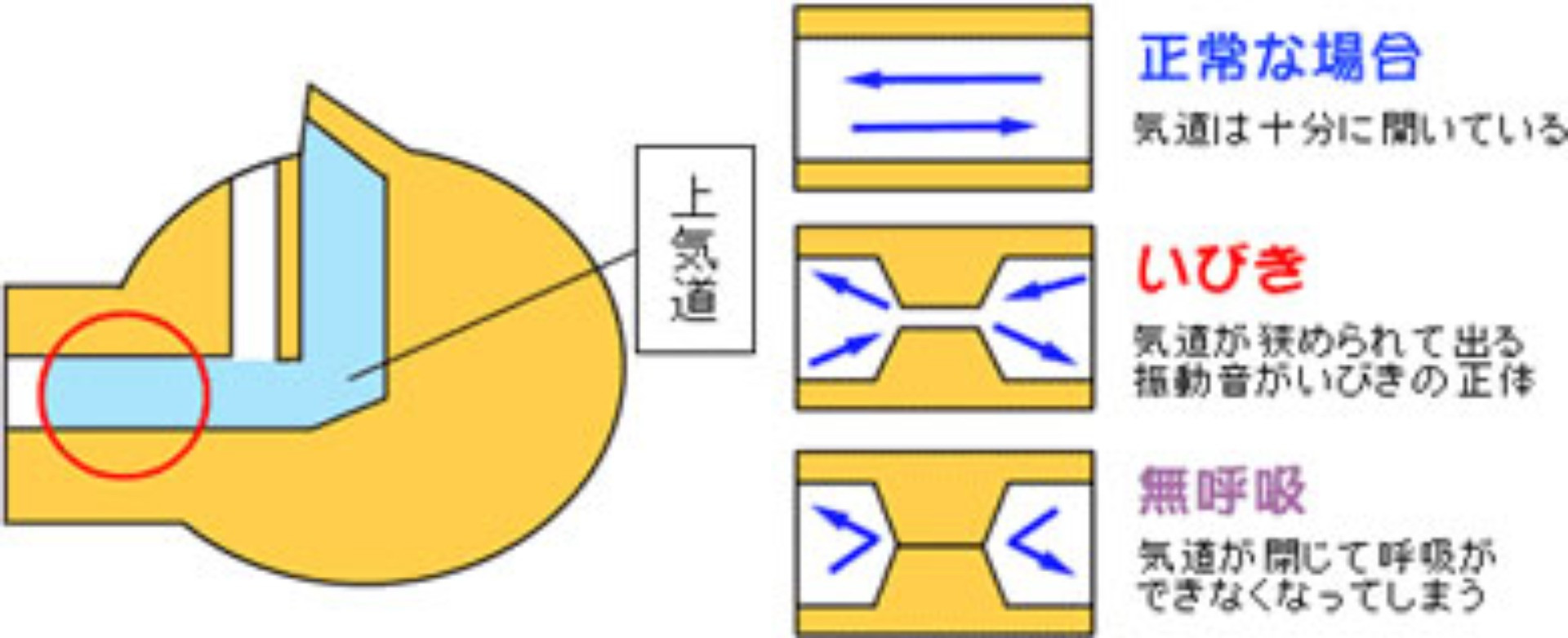 いびきのメカニズム