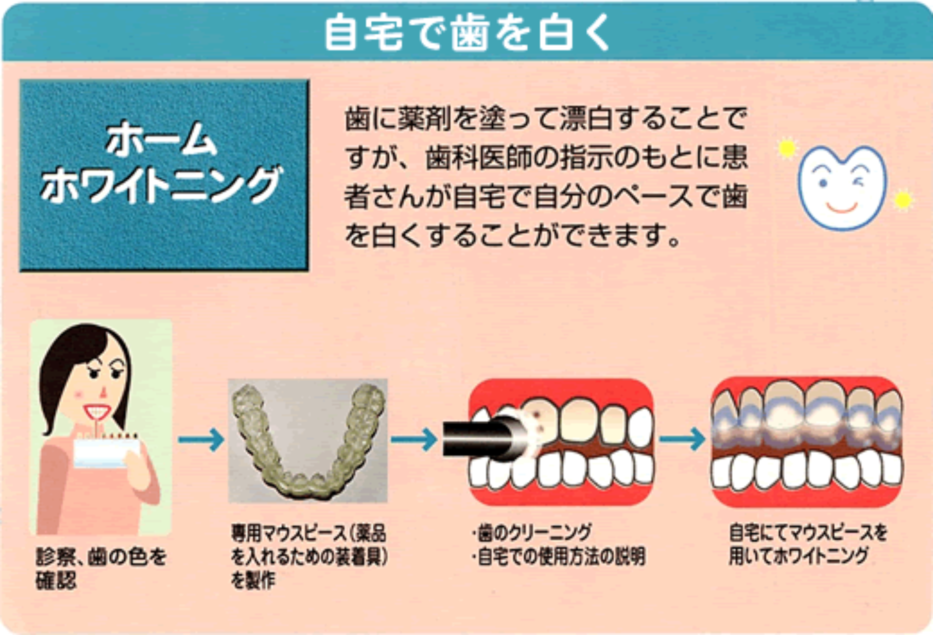 自宅で歯を白く