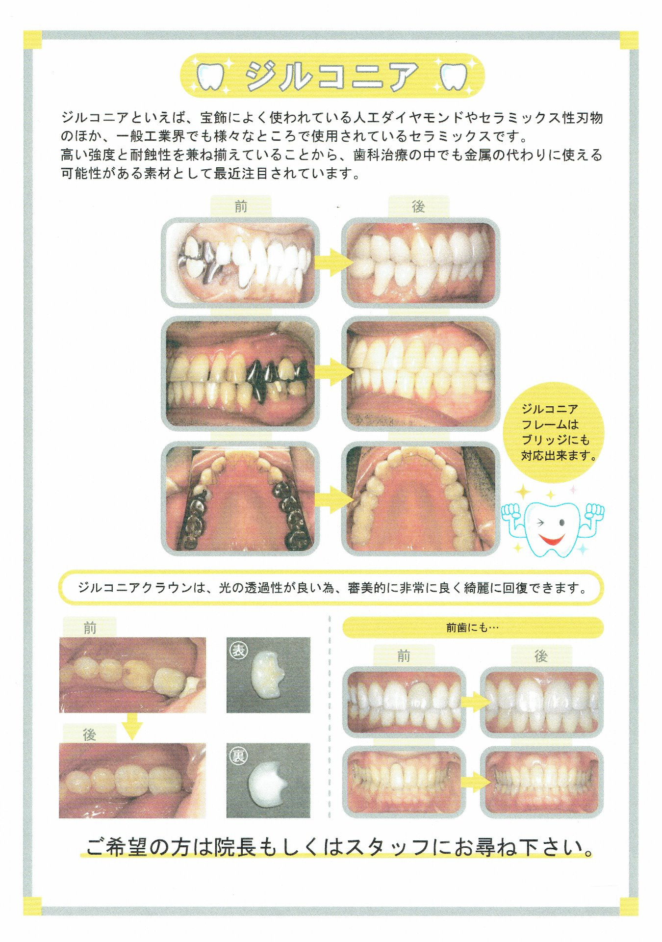 自費治療